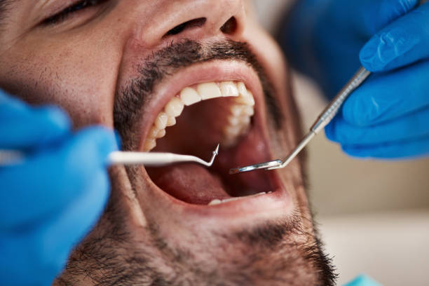 Best Urgent Dental Care for Toothache in Sully Square, VA