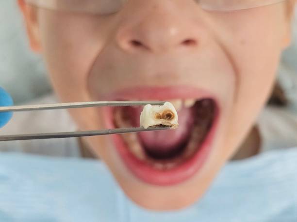 Best Orthodontic Emergency Dentist in Sully Square, VA